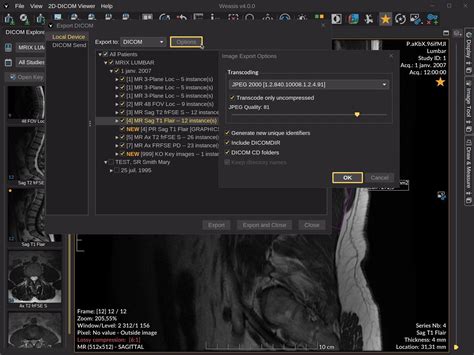 waises|Download Weasis DICOM Viewer :: Weasis Documentation.